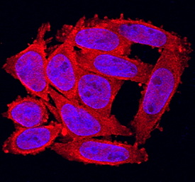 FGF-20 was detected in immersion fixed SW480 human colorectal adenocarcinoma cell line using Rat Anti-Human FGF-20 Monoclonal Antibody (Catalog # MAB2547) at 10 µg/mL for 3 hours at room temperature. Cells were stained using the NorthernLights™ 557-conjugated Anti-Rat IgG Secondary Antibody (red; Catalog # NL013) and counterstained with DAPI (blue). Specific staining was localized to cytoplasm. View our protocol for Fluorescent ICC Staining of Cells on Coverslips.
