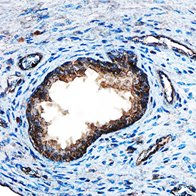 FGF-8 was detected in immersion fixed paraffin-embedded sections of human prostate using Goat Anti-Mouse FGF-8 b Isoform Antigen Affinity-purified Polyclonal Antibody (Catalog # AF-423-NA) at 15 µg/mL overnight at 4 °C. Tissue was stained using the Anti-Goat HRP-DAB Cell & Tissue Staining Kit (brown; Catalog # CTS008) and counterstained with hematoxylin (blue). Specific staining was localized to epithelial and endothelial cells. View our protocol for Chromogenic IHC Staining of Paraffin-embedded Tissue Sections.