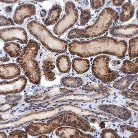 Immunohistochemistry FGFR3 Antibody (136312) [Unconjugated] - (IIIc)