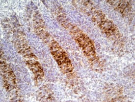 FGF R4 was detected in immersion fixed frozen sections of mouse embryo (11.5 d.p.c.) using Goat Anti-Mouse FGF R4 Antigen Affinity-purified Polyclonal Antibody (Catalog # AF2265) at 5 µg/mL overnight at 4 °C. Tissue was stained using the Anti-Goat HRP-DAB Cell & Tissue Staining Kit (brown; Catalog # CTS008) and counterstained with hematoxylin (blue). Specific staining was localized to cartilage. View our protocol for Chromogenic IHC Staining of Frozen Tissue Sections.