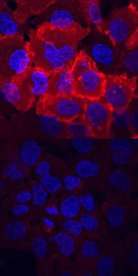 <b>Biological Strategies Validation. </b>FGF R1-4 phosphorylated at Y653/Y654 was detected in immersion fixed A431 human epithelial carcinoma cell line untreated (lower panel) or treated (upper panel) with pervanadate using Rabbit Anti-Human Phospho-FGF R1-4 (Y653/Y654) Antigen Affinity-purified Polyclonal Antibody (Catalog # AF3285) at 10 µg/mL for 3 hours at room temperature. Cells were stained using the NorthernLights™ 557-conjugated Anti-Rabbit IgG Secondary Antibody (red; Catalog # NL004) and counterstained with DAPI (blue). View our protocol for Fluorescent ICC Staining of Cells on Coverslips.