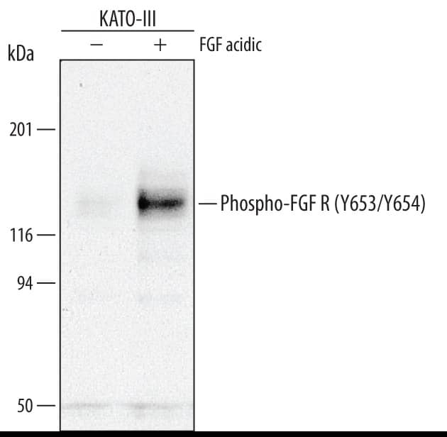 Western blot shows lysates of KATO-III human gastric carcinoma cell line untreated (-) or treated (+) with 100 ng/mL Recom-binant Human FGF acidic (Catalog # 232-FA) for 15 minutes. PVDF membrane was probed with 0.5 µg/mL of Rabbit Anti-Human Phospho-FGF R1-4 (Y653/Y654) Antigen Affinity-purified Polyclonal Antibody (Catalog # AF3285), followed by HRP-conjugated Anti-Rabbit IgG Secondary Antibody (Catalog # HAF008). A specific band was detected for Phospho-FGF R1-4 (Y653/Y654) at approximately 120 to 145 kDa (as indicated). This experiment was conducted under reducing conditions and using Immunoblot Buffer Group 1.