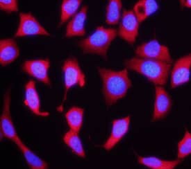 FGF R4 was detected in immersion fixed MCF-7 human breast cancer cell line using Rat Anti-Human FGF R4 Monoclonal Antibody (Catalog # MAB6852) at 10 µg/mL for 3 hours at room temperature. Cells were stained using the NorthernLights™ 557-conjugated Anti-Rat IgG Secondary Antibody (red; NL013) and counterstained with DAPI (blue). Specific staining was localized to cytoplasm. View our protocol for Fluorescent ICC Staining of Cells on Coverslips.