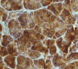 FGF R4 was detected in immersion fixed paraffin-embedded sections of human pancreas using Rat Anti-Human FGF R4 Monoclonal Antibody (Catalog # MAB6852) at 15 µg/mL overnight at 4 °C. Tissue was stained using the Anti-Rat HRP-DAB Cell & Tissue Staining Kit (brown; CTS017) and counterstained with hematoxylin (blue). Specific staining was localized to cytoplasm. View our protocol for Chromogenic IHC Staining of Paraffin-embedded Tissue Sections.