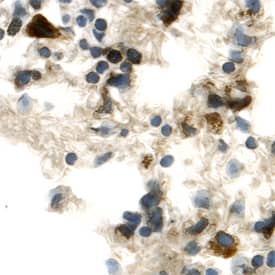 Immunohistochemistry FGFR5/FGFRL1 Antibody