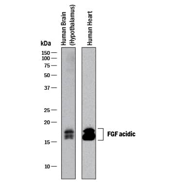 Western Blot FGF acidic/FGF1 Antibody [Unconjugated]