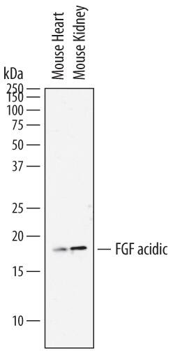Western Blot FGF acidic/FGF1 Antibody [Unconjugated]