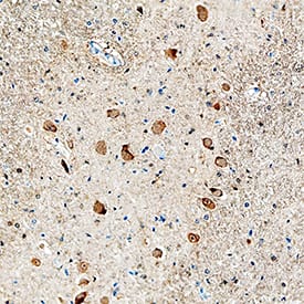 FGF acidic/FGF1 was detected in immersion fixed paraffin-embedded sections of human brain using Mouse Anti-Human FGF acidic/FGF1 Monoclonal Antibody (Catalog # MAB2321) at 5 µg/mL overnight at 4 °C. Tissue was stained using the Anti-Mouse HRP-DAB Cell & Tissue Staining Kit (brown; Catalog # CTS002) and counterstained with hematoxylin (blue). Specific staining was localized to neuronal cytoplasm. View our protocol for Chromogenic IHC Staining of Paraffin-embedded Tissue Sections.