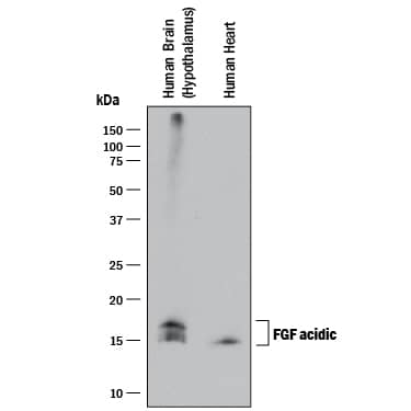 Western blot shows lysates of human brain (hypothalamus) tissue and human heart tissue. PVDF membrane was probed with 1 µg/mL of Mouse Anti-Human FGF acidic/FGF1 Monoclonal Antibody (Catalog # MAB2321) followed by HRP-conjugated Anti-Mouse IgG Secondary Antibody (Catalog # HAF018). Specific bands were detected for FGF acidic/FGF1 at approximately 16-17 kDa (as indicated). This experiment was conducted under reducing conditions and using Immunoblot Buffer Group 1.