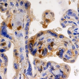 FGF basic/FGF2/bFGF was detected in immersion fixed paraffin-embedded sections of human placenta using Goat Anti-Human FGF basic/FGF2/bFGF Antigen Affinity-purified Polyclonal Antibody (Catalog # AF-233-NA) at 10 µg/mL overnight at 4 °C. Before incubation with the primary antibody, tissue was subjected to heat-induced epitope retrieval using Antigen Retrieval Reagent-Basic (Catalog # CTS013). Tissue was stained using the Anti-Goat HRP-DAB Cell & Tissue Staining Kit (brown; Catalog # CTS008) and counterstained with hematoxylin (blue). Specific staining was localized to trophoblast cells in chorionic villi. View our protocol for Chromogenic IHC Staining of Paraffin-embedded Tissue Sections.