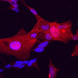 Immunocytochemistry FHL1 Antibody (767418)
