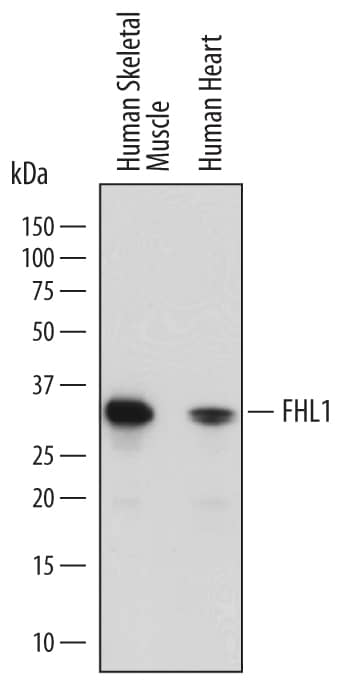 Western Blot FHL1 Antibody (767418)