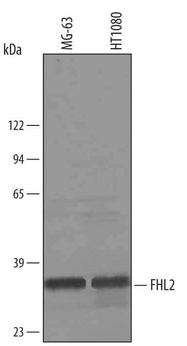 Western blot shows lysates of HT1080 human fibrosarcoma cell line and MG-63 human osteosarcoma cell line. PVDF membrane was probed with 1 µg/mL of Goat Anti-Human FHL2 Antigen Affinity-purified Polyclonal Antibody (Catalog # AF4758) followed by HRP-conjugated Anti-Goat IgG Secondary Antibody (Catalog # HAF019). A specific band was detected for FHL2 at approximately 32 kDa (as indicated). This experiment was conducted under reducing conditions and using Immunoblot Buffer Group 8.