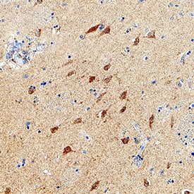 Immunohistochemistry FKBP12.6 Antibody [Unconjugated]