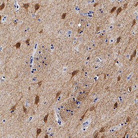 FKBP12 and FKBP12.6 was detected in immersion fixed paraffin-embedded sections of human brain (caudate putamen) using Rat Anti-Human/Mouse/Rat FKBP12/FKBP12.6 Monoclonal Antibody (Catalog # MAB4174) at 5 µg/mL for 1 hour at room temperature followed by incubation with the Anti-Rat IgG VisUCyte™ HRP Polymer Antibody (Catalog # VC005). Before incubation with the primary antibody, tissue was subjected to heat-induced epitope retrieval using Antigen Retrieval Reagent-Basic (Catalog # CTS013). Tissue was stained using DAB (brown) and counterstained with hematoxylin (blue). Specific staining was localized to cytoplasm in neurons. View our protocol for IHC Staining with VisUCyte HRP Polymer Detection Reagents.