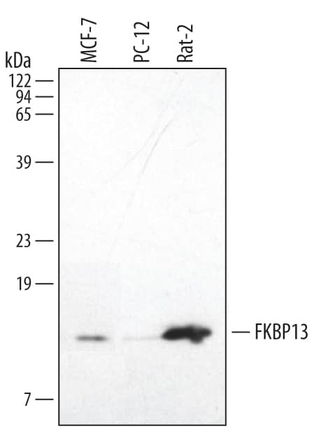 Western Blot FKBP13/FKBP2 Antibody (422617)