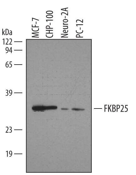 Western Blot FKBP25 Antibody