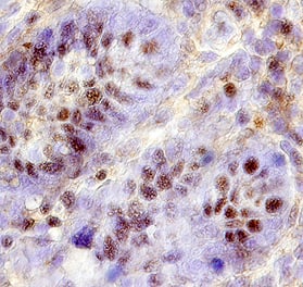 FKBP38 was detected in immersion fixed paraffin-embedded sections of human intestine using 15 µg/mL Goat Anti-Human/Mouse/Rat FKBP38 Antigen Affinity-purified Polyclonal Antibody (Catalog # AF3580) overnight at 4 °C. Tissue was stained with the Anti-Goat HRP-DAB Cell & Tissue Staining Kit (brown; Catalog # CTS008) and counterstained with hematoxylin (blue). Specific labeling was localized to the nucleus of epithelial cells in intestinal glands. View our protocol for Chromogenic IHC Staining of Paraffin-embedded Tissue Sections. This application has not been tested in rat or mouse tissue.