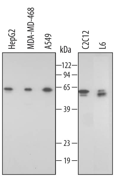 Western blot shows lysates of HepG2 human hepatocellular carcinoma cell line, MDA-MB-468 human breast cancer cell line, A549 human lung carcinoma cell line, C2C12 mouse myoblast cell line, and L6 rat myoblast cell line. PVDF membrane was probed with 0.5 µg/mL of Goat Anti-Human/Mouse/Rat FKBP38 Antigen Affinity-purified Polyclonal Antibody (Catalog # AF3580) followed by HRP-conjugated Anti-Goat IgG Secondary Antibody (Catalog # HAF109). A specific band was detected for FKBP38 at approximately 60 - 64 kDa (as indicated). This experiment was conducted under reducing conditions and using Immunoblot Buffer Group 2.
