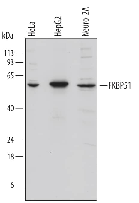 Western blot shows lysates of HeLa human cervical epithelial carcinoma cell line, HepG2 human hepatocellular carcinoma cell line, and Neuro-2A mouse neuroblastoma cell line. PVDF membrane was probed with 1 µg/mL of Human/Mouse/Rat FKBP51 Monoclonal Antibody (Catalog # MAB4094) followed by HRP-conjugated Anti-Rat IgG Secondary Antibody (Catalog # HAF005). A specific band was detected for FKBP51 at approximately 51 kDa (as indicated). This experiment was conducted under reducing conditions and using Immunoblot Buffer Group 1.