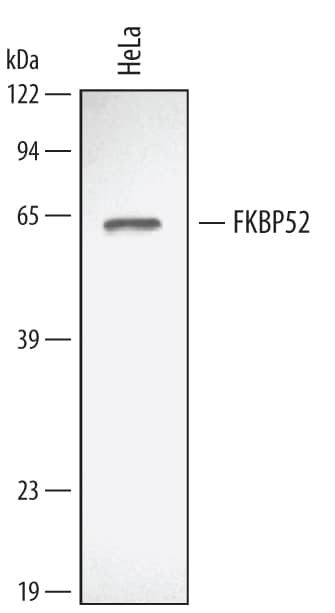 Western blot shows lysates of HeLa human cervical epithelial carcinoma cell line. PVDF membrane was probed with 0.3 µg/mL of Human/Mouse/Rat FKBP52 Antigen Affinity‑purified Polyclonal Antibody (Catalog # AF4095) followed by HRP-conjugated Anti‑Goat IgG Secondary Antibody (Catalog # HAF109). A specific band was detected for FKBP52 at approximately 52 kDa (as indicated). This experiment was conducted using Immunoblot Buffer Group 2.