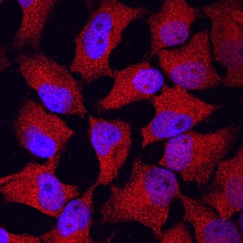 FOLR1 was detected in immersion fixed HeLa human cervical epithelial carcinoma cell line using Sheep Anti-Mouse FOLR1 Antigen Affinity-purified Polyclonal Antibody (Catalog # AF6936) at 10 µg/mL for 3 hours at room temperature. Cells were stained using the NorthernLights™ 557-conjugated Anti-Sheep IgG Secondary Antibody (red; Catalog # NL010) and counterstained with DAPI (blue). Specific staining was localized to cytoplasm. View our protocol for Fluorescent ICC Staining of Cells on Coverslips.