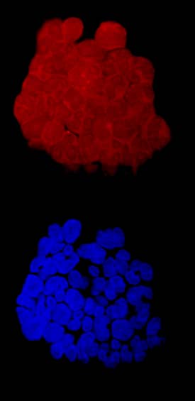 Immunocytochemistry FOLR2 Antibody