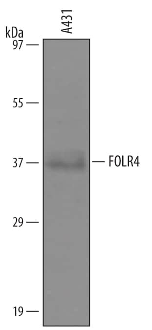 Western blot shows lysates of A431 human epithelial carcinoma cell line. PVDF Membrane was probed with 1 µg/mL of Sheep Anti-Human FOLR4 Antigen Affinity-purified Polyclonal Antibody (Catalog # AF6328) followed by HRP-conjugated Anti-Sheep IgG Secondary Antibody (Catalog # HAF016). A specific band was detected for FOLR4 at approximately 36 kDa (as indicated). This experiment was conducted under reducing conditions and using Immunoblot Buffer Group 8.