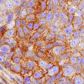 Immunohistochemistry FPRP/PTGFRN Antibody (998175) [Unconjugated]