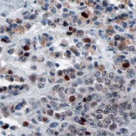 Immunohistochemistry FRA-1/FOSL1 Antibody
