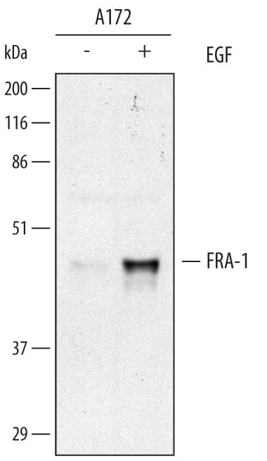 Western Blot FRA-1/FOSL1 Antibody