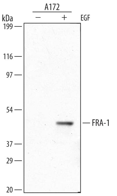 Western blot shows lysates of A172 human glioblastoma cell line untreated (-) or treated (+) with 100 ng/mL Recombinant Human EGF (Catalog # 236-EG) for 18 hours. PVDF Membrane was probed with 1 µg/mL of Human FRA-1 Monoclonal Antibody (Catalog # MAB4935) followed by HRP-conjugated Anti-Mouse IgG Secondary Antibody (Catalog # HAF007). A specific band was detected for FRA-1 at approximately 45 kDa (as indicated). This experiment was conducted under reducing conditions and using Immunoblot Buffer Group 1.