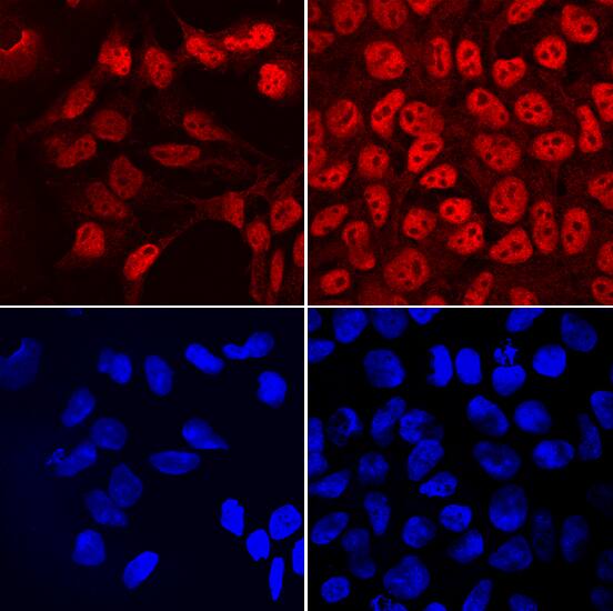 FRAT2 was detected in immersion fixed NTera-2 human testicular embryonic carcinoma cell line cultured with (left panels) and without (right panels) 10µM retinoic acid for 4 days using Sheep Anti-Human FRAT2 Antigen Affinity-purified Polyclonal Antibody (Catalog # AF7980) at 10 µg/mL for 3 hours at room temperature. Cells were stained using the NorthernLights™ 557-conjugated Anti-Sheep IgG Secondary Antibody (red, upper panels; Catalog # NL010) and counterstained with DAPI (blue, lower panels). Specific staining was localized to nuclei. View our protocol for Fluorescent ICC Staining of Cells on Coverslips.