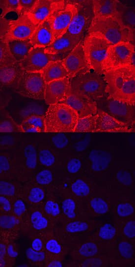 <b>Biological Strategies Validation. </b>FRS2 phosphorylated at Y436 was detected in immersion fixed A431 human epithelial carcinoma cell line untreated (lower panel) or treated (upper panel) with pervanadate using Rabbit Anti-Human/Mouse/Rat Phospho-FRS2 (Y436) Antigen Affinity-purified Polyclonal Antibody (Catalog # AF5126) at 10 µg/mL for 3 hours at room temperature. Cells were stained using the NorthernLights™ 557-conjugated Anti-Rabbit IgG Secondary Antibody (red; Catalog # NL004) and counterstained with DAPI (blue). View our protocol for Fluorescent ICC Staining of Cells on Coverslips.