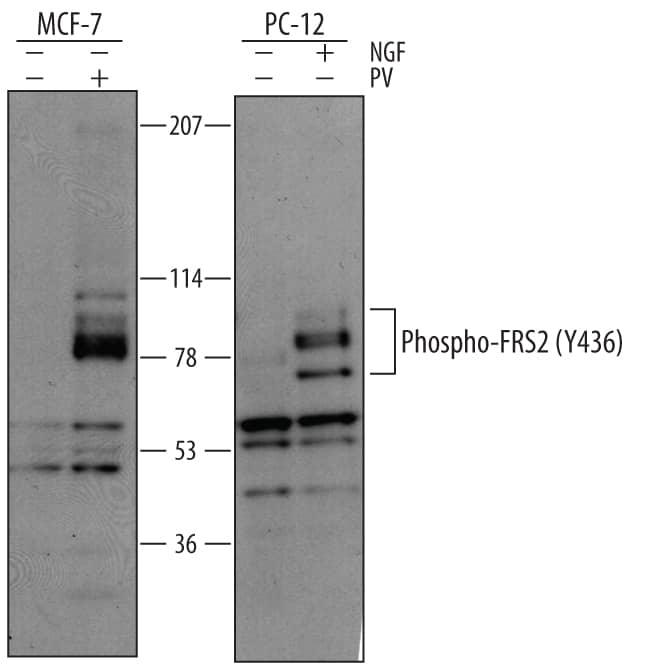 Western blot shows lysates of MCF-7 human breast cancer cell line untreated (-) or treated (+) with 100 µM pervanadate (PV) for 10 minutes and PC-12 rat adrenal pheochromocytoma cell line untreated or treated with 100 ng/mL Recombinant Rat  beta -NGF (Catalog # 556-NG) for 10 minutes. PVDF membrane was probed with 1 µg/mL of Rabbit Anti-Human/Mouse/Rat Phospho-FRS2 (Y436) Antigen Affinity-purified Polyclonal Antibody (Catalog # AF5126), followed by HRP-conjugated Anti-Rabbit IgG Secondary Antibody (Catalog # HAF008). Bands were detected for Phospho-FRS2 (Y436) at approximately 70 - 90 kDa (as indicated). This experiment was conducted under reducing conditions and using Immunoblot Buffer Group 1.