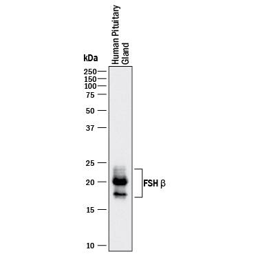 Western Blot FSH beta Antibody (961416) [Unconjugated]