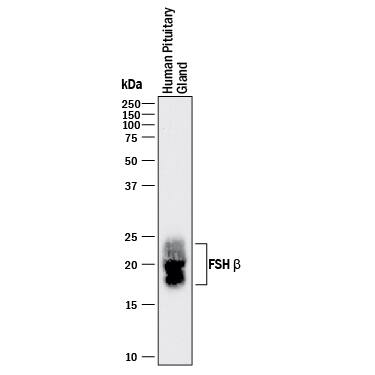 Western Blot FSH beta Antibody (961417) [Unconjugated]