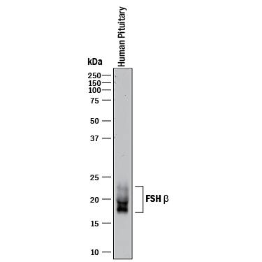 Western Blot FSH beta Antibody (405326) [Unconjugated]
