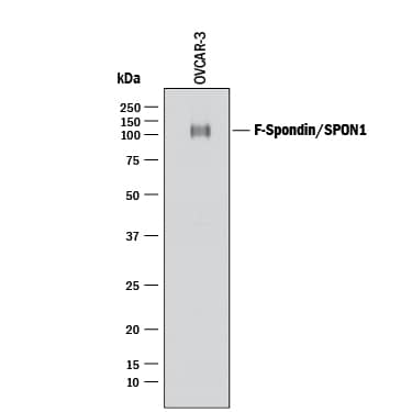 Western Blot F-Spondin/SPON1 Antibody [Unconjugated]