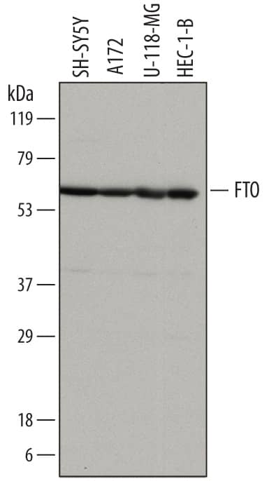 Western blot shows lysates of SH-SY5Y human neuroblastoma cell line, A172 human glioblastoma cell line, U-118-MG human glioblastoma/astrocytoma cell line, and HEC-1-B human endometrial adenocarcinoma cell line. PVDF membrane was probed with 1 µg/mL of Sheep Anti-Human FTO Antigen Affinity-purified Polyclonal Antibody (Catalog # AF7208) followed by HRP-conjugated Anti-Sheep IgG Secondary Antibody (Catalog # HAF016). A specific band was detected for FTO at approximately 58 kDa (as indicated). This experiment was conducted under reducing conditions and using Immunoblot Buffer Group 1.