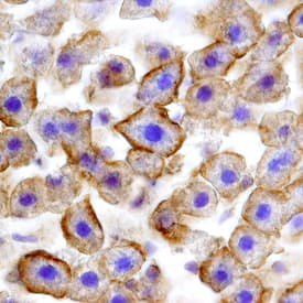 Fas/TNFRSF6/CD95 was detected in perfusion fixed frozen sections of rat liver using Goat Anti-Rat Fas/TNFRSF6/CD95 Antigen Affinity-purified Polyclonal Antibody (Catalog # AF2159) at 15 µg/mL overnight at 4 °C. Tissue was stained using the Anti-Goat HRP-DAB Cell & Tissue Staining Kit (brown; Catalog # CTS008) and counterstained with hematoxylin (blue). Specific staining was localized to hepatocyte cell membranes. View our protocol for Chromogenic IHC Staining of Frozen Tissue Sections.