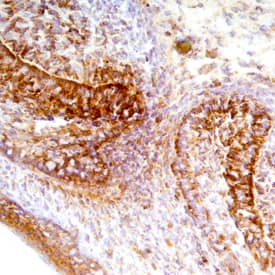Fas/TNFRSF6/CD95 was detected in immersion fixed frozen sections of mouse embryo (E15) using Goat Anti-Mouse Fas/TNFRSF6/CD95 Antigen Affinity-purified Polyclonal Antibody (Catalog # AF435) at 10 µg/mL overnight at 4 °C. Tissue was stained using the Anti-Goat HRP-DAB Cell & Tissue Staining Kit (brown; Catalog # CTS008) and counterstained with hematoxylin (blue). Specific staining was localized to olfactory epithelial cells. View our protocol for Chromogenic IHC Staining of Frozen Tissue Sections.