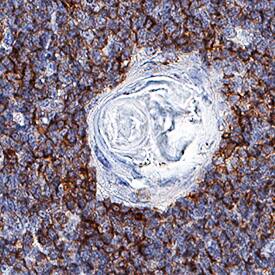 Fas Ligand/TNFSF6 was detected in immersion fixed paraffin-embedded sections of human thymus (Hassall's corpuscle) using Mouse Anti-Human Fas Ligand/TNFSF6 Monoclonal Antibody (Catalog # MAB0951) at 5 µg/mL for 1 hour at room temperature followed by incubation with the Anti-Mouse IgG VisUCyte™ HRP Polymer Antibody (Catalog # VC001). Before incubation with the primary antibody, tissue was subjected to heat-induced epitope retrieval using Antigen Retrieval Reagent-Basic (Catalog # CTS013). Tissue was stained using DAB (brown) and counterstained with hematoxylin (blue). Specific staining was localized to cytoplasm. View our protocol for IHC Staining with VisUCyte HRP Polymer Detection Reagents.