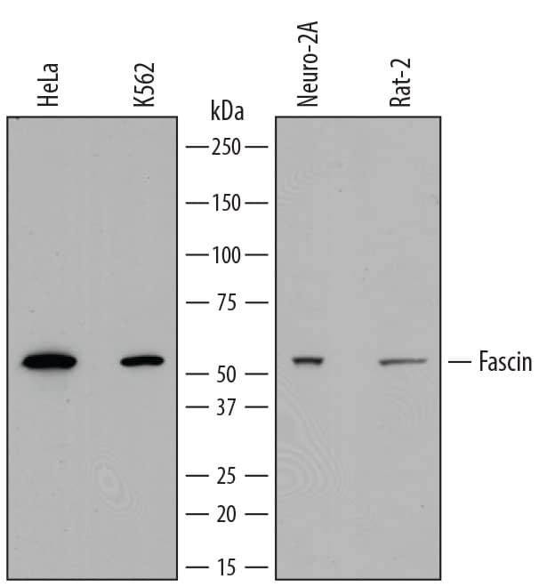 Western blot shows lysates of HeLa human cervical epithelial carcinoma cell line, K562 human chronic myelogenous leukemia cell line, Neuro-2A mouse neuroblastoma cell line, and Rat-2 rat thymidine kinase-deficient embryonic fibroblast cell line. PVDF membrane was probed with 0.4 µg/mL of Sheep Anti-Human/Mouse/Rat Fascin Antigen Affinity-purified Polyclonal Antibody (Catalog # AF7745) followed by HRP-conjugated Anti-Sheep IgG Secondary Antibody (Catalog # HAF016). A specific band was detected for Fascin at approximately 55 kDa (as indicated). This experiment was conducted under reducing conditions using Immunoblot Buffer Group 1.