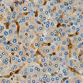Fascin was detected in immersion fixed paraffin-embedded sections of human liver using Mouse Anti-Human Fascin Monoclonal Antibody (Catalog # MAB7745) at 15 µg/mL overnight at 4 °C. Before incubation with the primary antibody, tissue was subjected to heat-induced epitope retrieval using Antigen Retrieval Reagent-Basic (Catalog # CTS013). Tissue was stained using the Anti-Mouse HRP-DAB Cell & Tissue Staining Kit (brown; Catalog # CTS002) and counterstained with hematoxylin (blue). Specific staining was localized to synusoids. View our protocol for Chromogenic IHC Staining of Paraffin-embedded Tissue Sections.