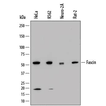 Western Blot Fascin Antibody (833223) [Unconjugated]