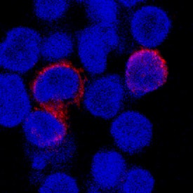 Fc gamma  RIII (CD16) was detected in immersion fixed human peripheral blood mononuclear cells (PBMCs) using Mouse Anti-Human Fc gamma  RIII (CD16) Monoclonal Antibody (Catalog # MAB43251) at 8 µg/mL for 3 hours at room temperature. Cells were stained using the NorthernLights™ 557-conjugated Anti-Mouse IgG Secondary Antibody (red; Catalog # NL007) and counterstained with DAPI (blue). Specific staining was localized to cell surface. View our protocol for Fluorescent ICC Staining of Non-adherent Cells.