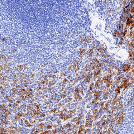 Fc gamma  RIII (CD16) was detected in immersion fixed paraffin-embedded sections of human spleen tissue using Mouse Anti-Human Fc gamma  RIII (CD16) Monoclonal Antibody (Catalog # MAB43251) at 5 µg/mL for 1 hour at room temperature followed by incubation with the Anti-Mouse IgG VisUCyte™ HRP Polymer Antibody (Catalog # VC001). Before incubation with the primary antibody, tissue was subjected to heat-induced epitope retrieval using Antigen Retrieval Reagent-Basic (Catalog # CTS013). Tissue was stained using DAB (brown) and counterstained with hematoxylin (blue). Specific staining was localized to cell surface and cytoplasm in lymphocytes. View our protocol for IHC Staining with VisUCyte HRP Polymer Detection Reagents.