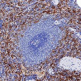 Fc gamma  RIII (CD16) was detected in immersion fixed paraffin-embedded sections of human spleen using Mouse Anti-Human Fc gamma  RIII (CD16) Monoclonal Antibody (Catalog # MAB4325) at 5 µg/mL for 1 hour at room temperature followed by incubation with the Anti-Mouse IgG VisUCyte™ HRP Polymer Antibody (Catalog # VC001). Before incubation with the primary antibody, tissue was subjected to heat-induced epitope retrieval using Antigen Retrieval Reagent-Basic (Catalog # CTS013). Tissue was stained using DAB (brown) and counterstained with hematoxylin (blue). Specific staining was localized to cytoplasm and cell surfaces in lymphocytes. View our protocol for IHC Staining with VisUCyte HRP Polymer Detection Reagents.