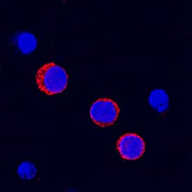 Immunocytochemistry Fc gamma RII/CD32 Antibody [Unconjugated]